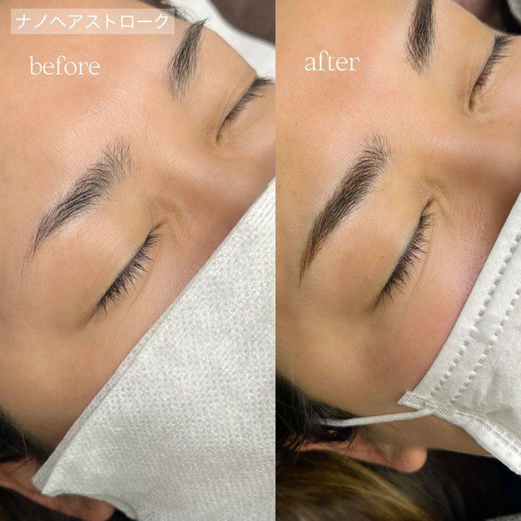 ナノヘアストローク