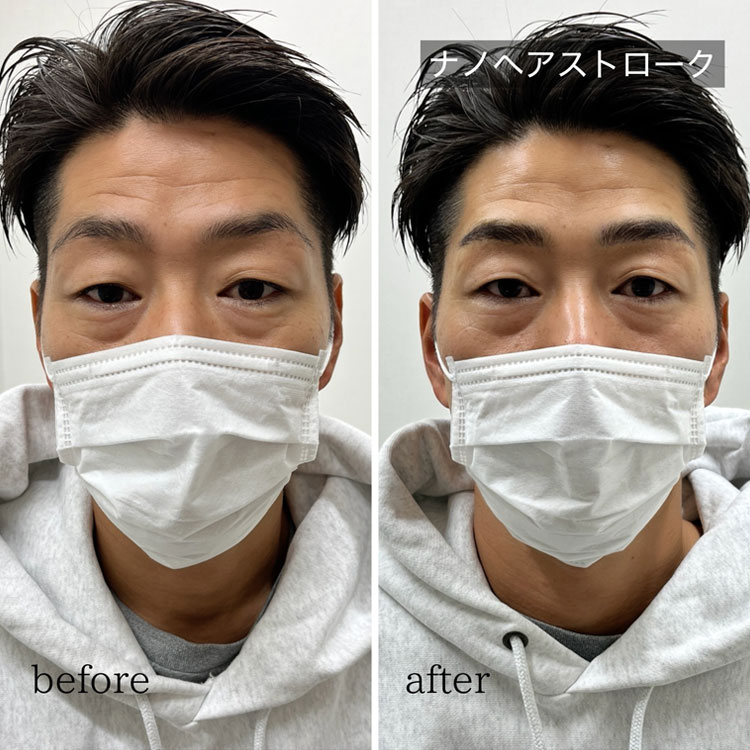 ナノヘアストローク